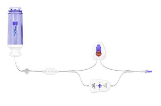 一次性使用便攜式輸注泵 非電驅(qū)動